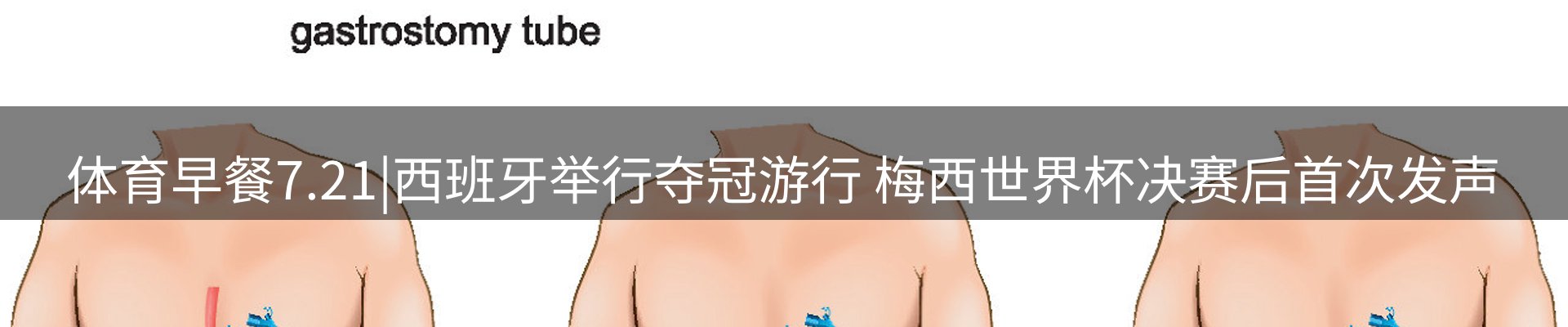 赛事资讯